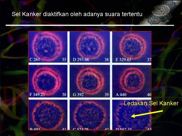 Sel Kanker diaktifkan oleh adanya suara tertentu Ledakan Sel Kanker 