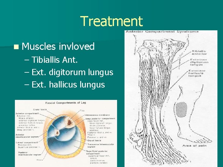 Treatment n Muscles invloved – Tibiallis Ant. – Ext. digitorum lungus – Ext. hallicus