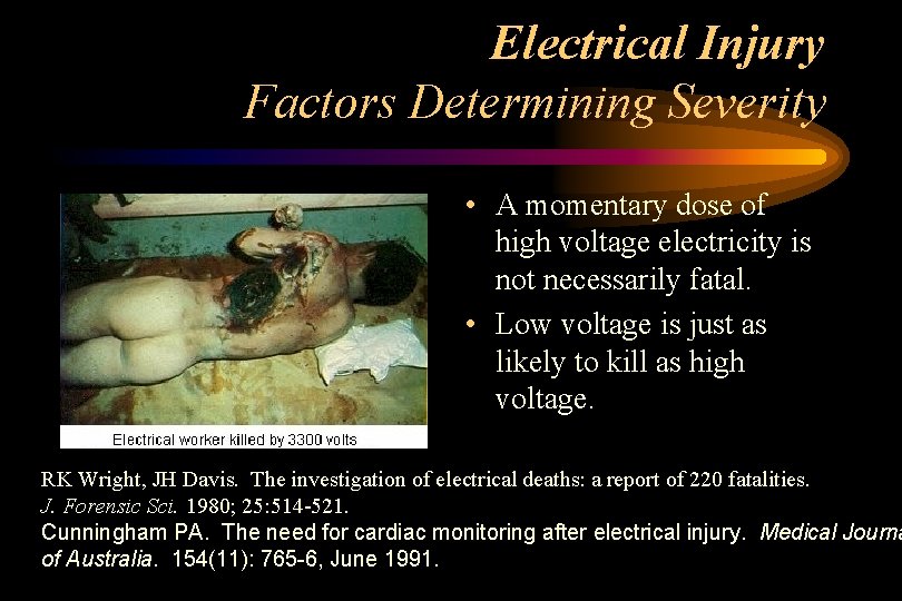 Electrical Injury Factors Determining Severity • A momentary dose of high voltage electricity is