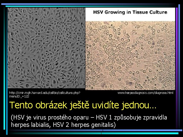 http: //cmir. mgh. harvard. edu/cellbio/cellculture. php? menu. ID_=122 www. herpesdiagnosis. com/diagnose. html Tento obrázek