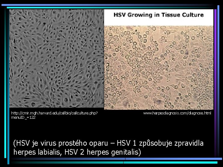 http: //cmir. mgh. harvard. edu/cellbio/cellculture. php? menu. ID_=122 www. herpesdiagnosis. com/diagnose. html (HSV je