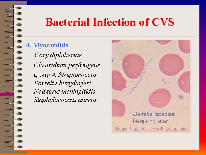 Bacterial Infection of CVS 4. Myocarditis Cory. diphtheriae Clostridium perfringens group A Streptococcus Borrelia