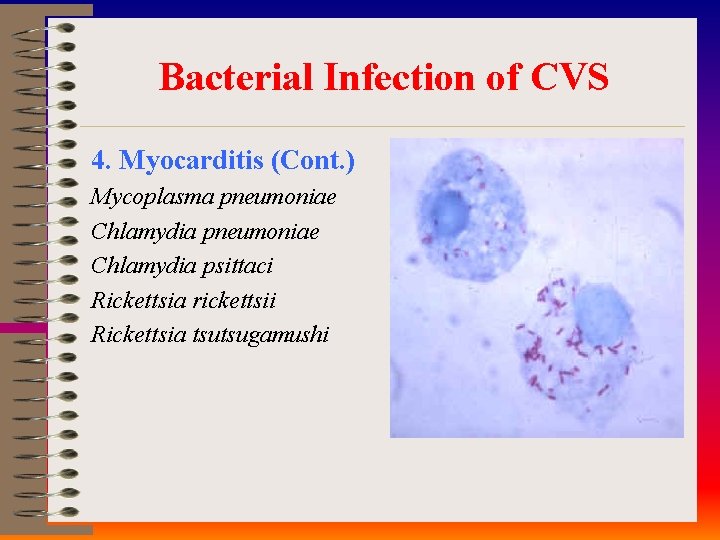 Bacterial Infection of CVS 4. Myocarditis (Cont. ) Mycoplasma pneumoniae Chlamydia psittaci Rickettsia rickettsii