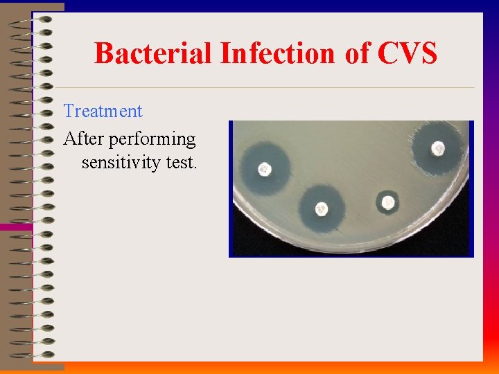 Bacterial Infection of CVS Treatment After performing sensitivity test. 