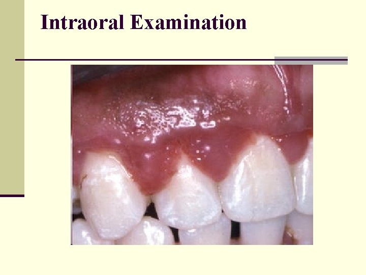 Examination Patient interview Intraoral and extraoral evaluation