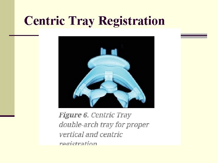Centric Tray Registration 