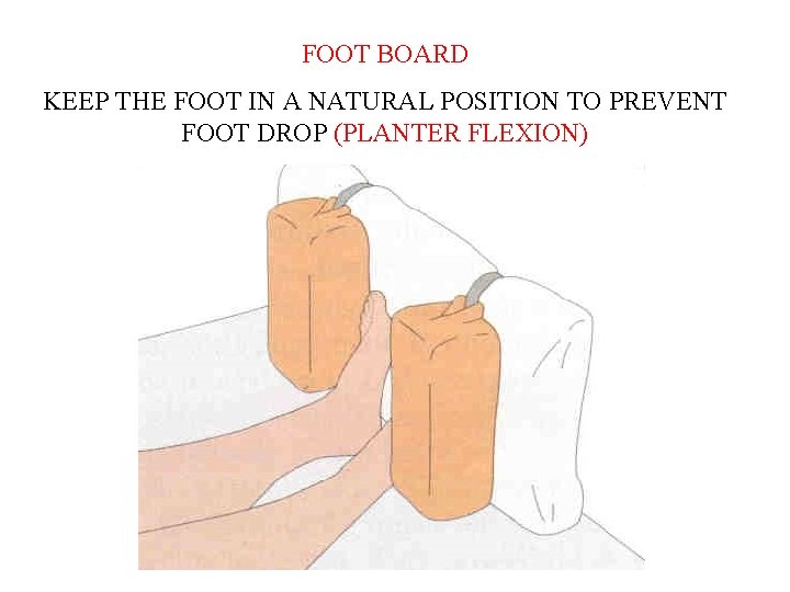 FOOT BOARD KEEP THE FOOT IN A NATURAL POSITION TO PREVENT FOOT DROP (PLANTER