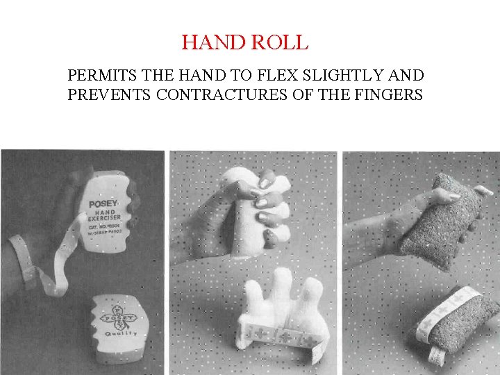 HAND ROLL PERMITS THE HAND TO FLEX SLIGHTLY AND PREVENTS CONTRACTURES OF THE FINGERS