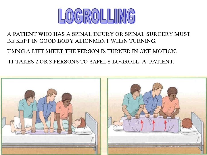 A PATIENT WHO HAS A SPINAL INJURY OR SPINAL SURGERY MUST BE KEPT IN