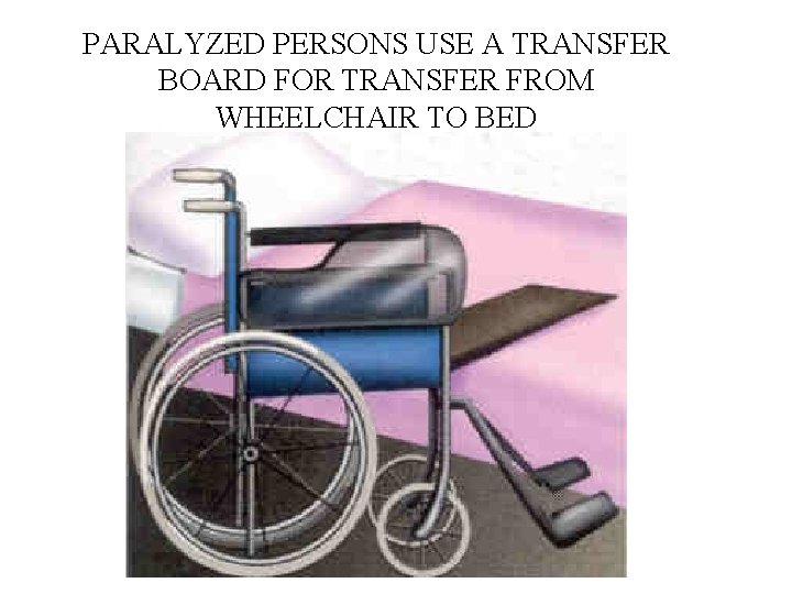 PARALYZED PERSONS USE A TRANSFER BOARD FOR TRANSFER FROM WHEELCHAIR TO BED 