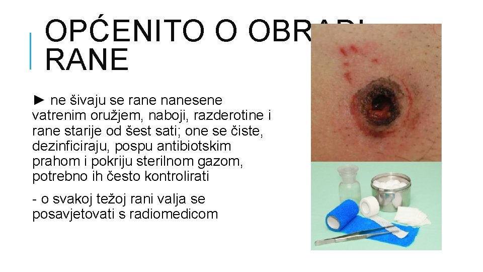 OPĆENITO O OBRADI RANE ► ne šivaju se rane nanesene vatrenim oružjem, naboji, razderotine