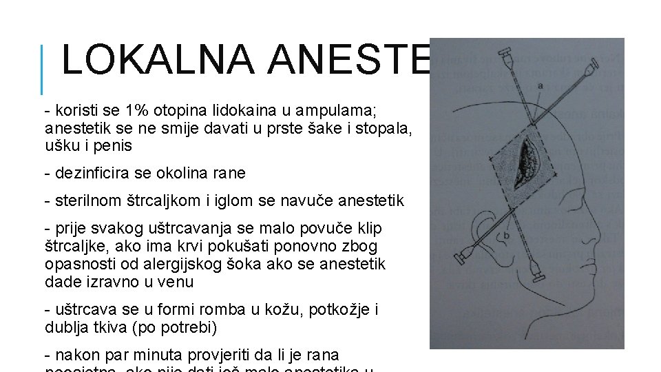 LOKALNA ANESTEZIJA - koristi se 1% otopina lidokaina u ampulama; anestetik se ne smije