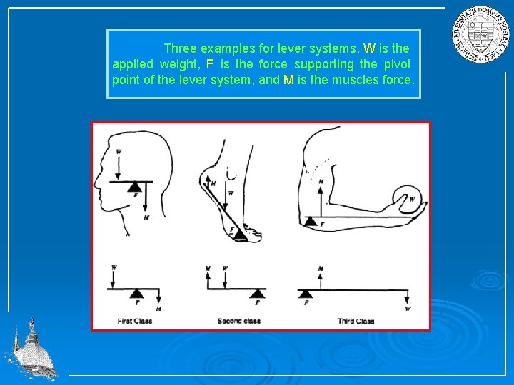 Three examples for lever systems, W is the applied weight, F is the force