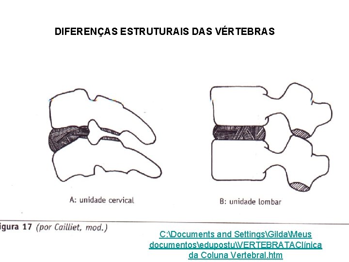 DIFERENÇAS ESTRUTURAIS DAS VÉRTEBRAS C: Documents and SettingsGildaMeus documentosedupostuVERTEBRATAClínica da Coluna Vertebral. htm 