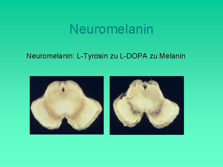 Neuromelanin: L-Tyrosin zu L-DOPA zu Melanin 