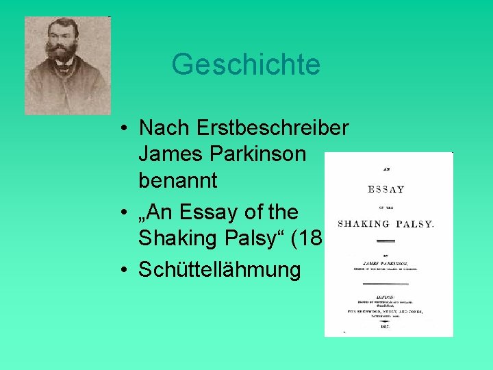 Geschichte • Nach Erstbeschreiber James Parkinson benannt • „An Essay of the Shaking Palsy“