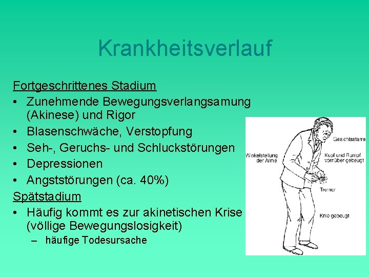 Krankheitsverlauf Fortgeschrittenes Stadium • Zunehmende Bewegungsverlangsamung (Akinese) und Rigor • Blasenschwäche, Verstopfung • Seh-,