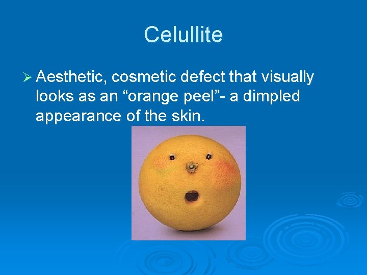 Celullite Ø Aesthetic, cosmetic defect that visually looks as an “orange peel”- a dimpled