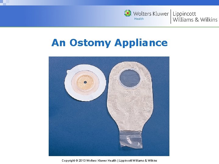An Ostomy Appliance Copyright © 2013 Wolters Kluwer Health | Lippincott Williams & Wilkins