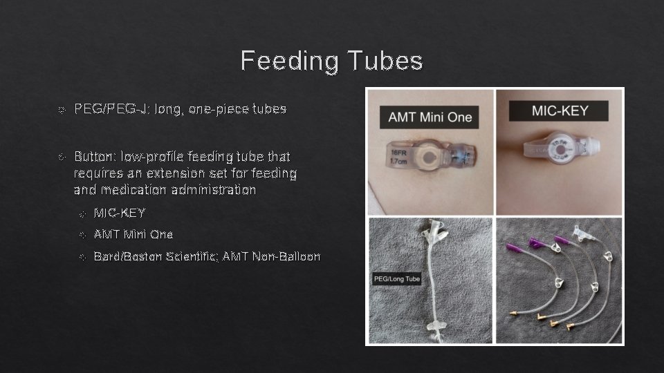 Feeding Tubes PEG/PEG-J: long, one-piece tubes Button: low-profile feeding tube that requires an extension