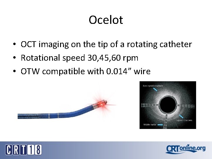 Ocelot • OCT imaging on the tip of a rotating catheter • Rotational speed