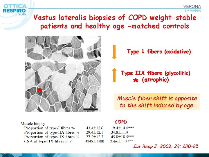 Vastus lateralis biopsies of COPD weight-stable patients and healthy age -matched controls Type 1