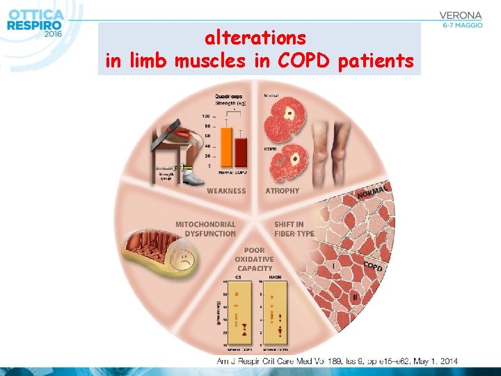 alterations in limb muscles in COPD patients 