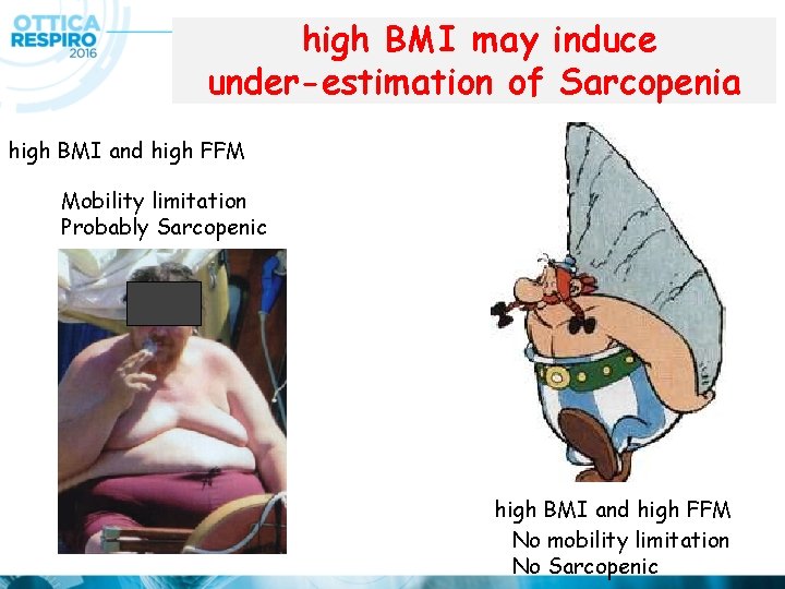 high BMI may induce under-estimation of Sarcopenia high BMI and high FFM Mobility limitation