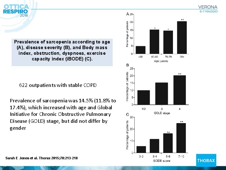 Prevalence of sarcopenia according to age (A), disease severity (B), and Body mass index,