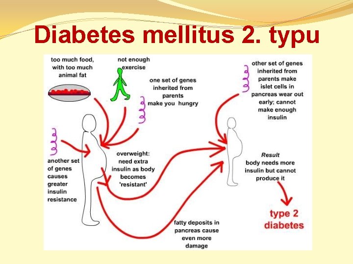 Diabetes mellitus 2. typu 