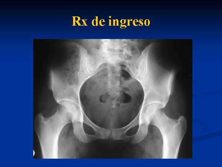 Rx de ingreso 