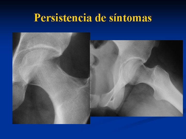 Persistencia de síntomas 