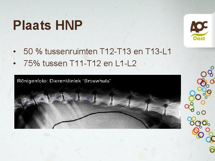 Plaats HNP • 50 % tussenruimten T 12 -T 13 en T 13 -L