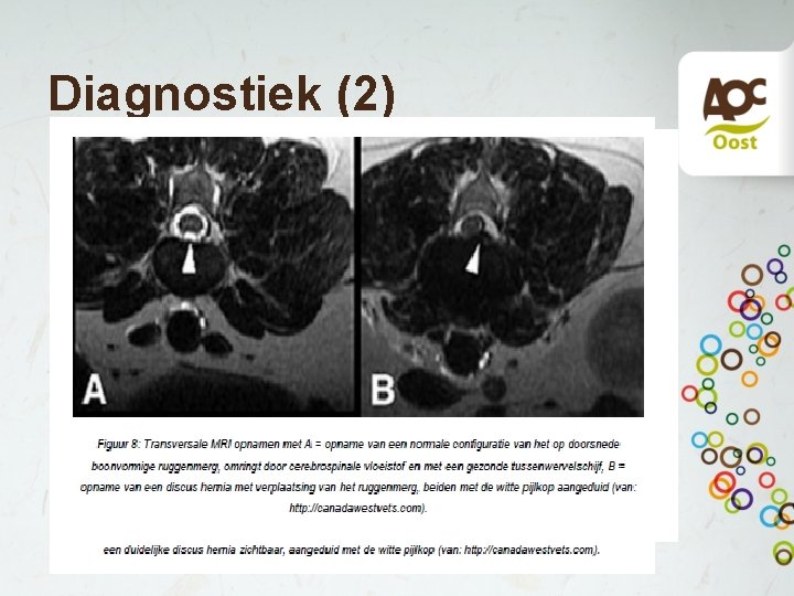 Diagnostiek (2) • MRI • Beste methode • Wel afhankelijk installatie • Weinig invasief