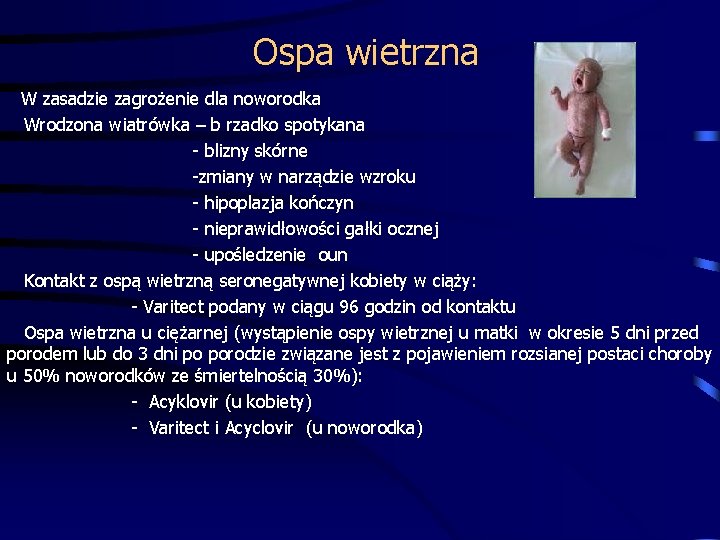 Ospa wietrzna W zasadzie zagrożenie dla noworodka Wrodzona wiatrówka – b rzadko spotykana -