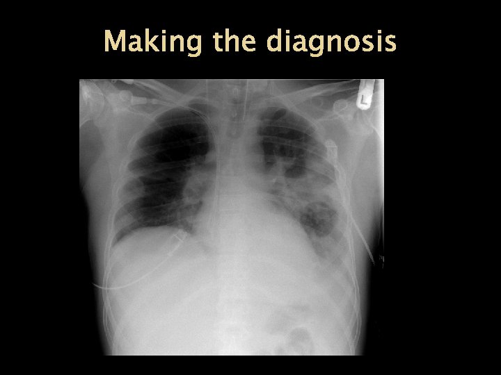 Making the diagnosis 