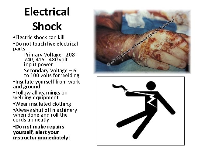 Electrical Shock • Electric shock can kill • Do not touch live electrical parts