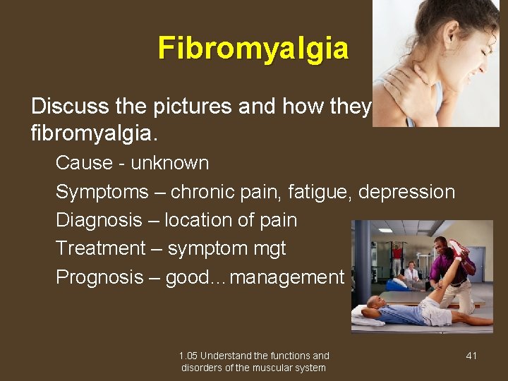 Fibromyalgia Discuss the pictures and how they relate to fibromyalgia. Cause - unknown Symptoms