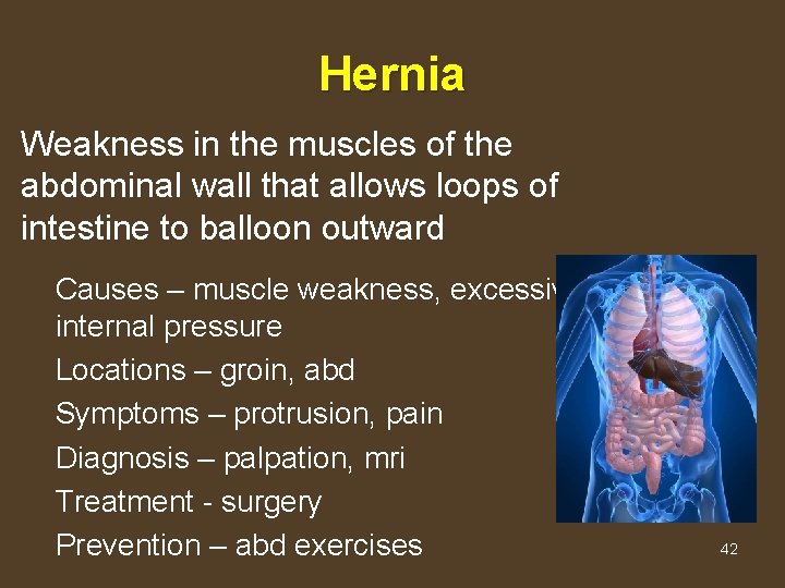 Hernia Weakness in the muscles of the abdominal wall that allows loops of intestine