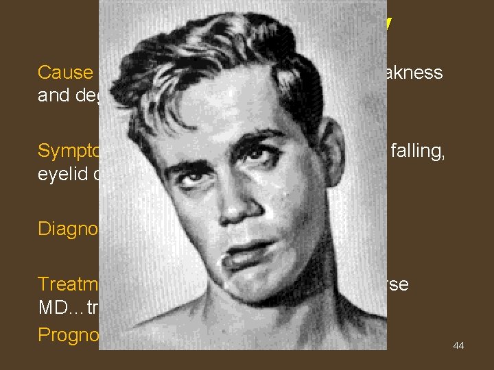 Muscular Dystrophy Cause – genetic defect…progressive weakness and degeneration of skeletal muscle Symptoms –