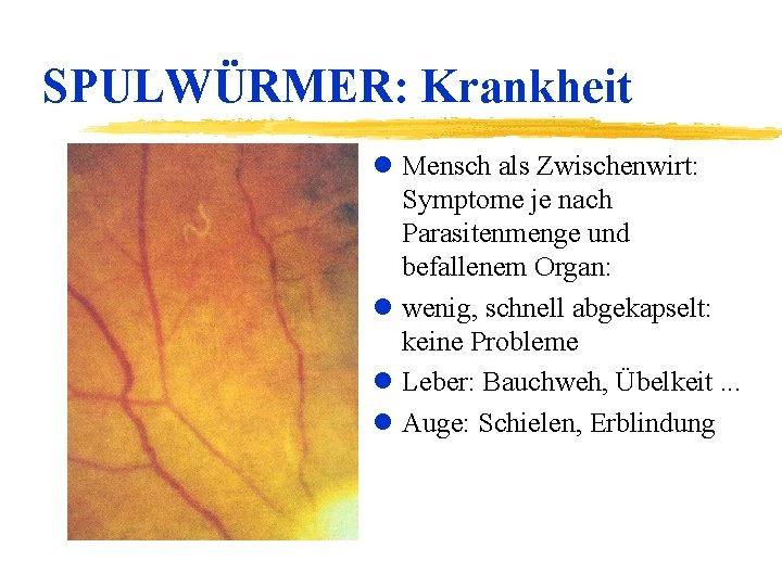 SPULWÜRMER: Krankheit l Mensch als Zwischenwirt: Symptome je nach Parasitenmenge und befallenem Organ: l