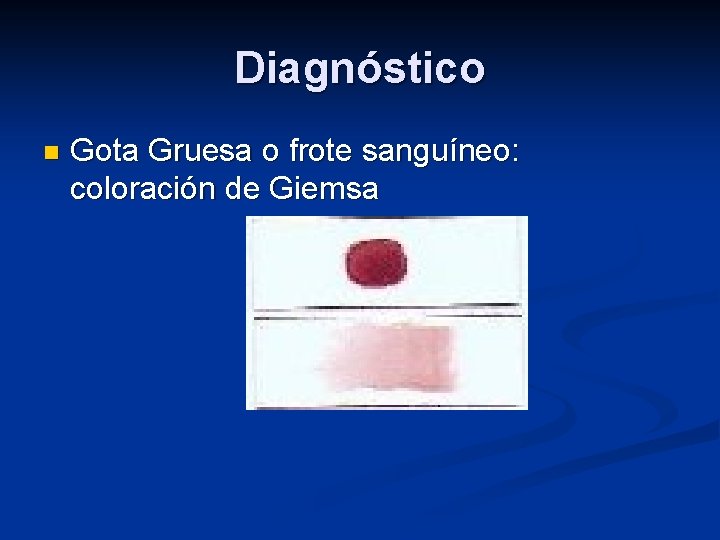 Diagnóstico n Gota Gruesa o frote sanguíneo: coloración de Giemsa 