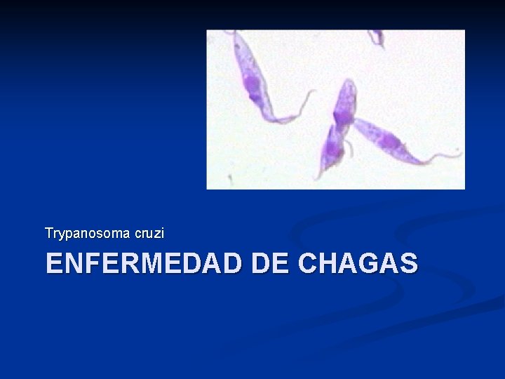 Trypanosoma cruzi ENFERMEDAD DE CHAGAS 