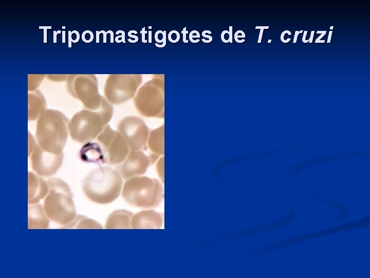 Tripomastigotes de T. cruzi 