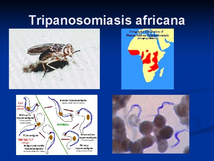 Tripanosomiasis africana 