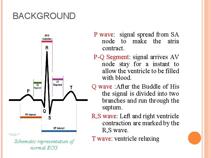 BACKGROUND Schematic representation of normal ECG P wave: signal spread from SA node to