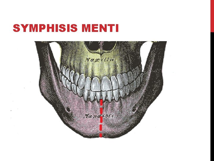SYMPHISIS MENTI 