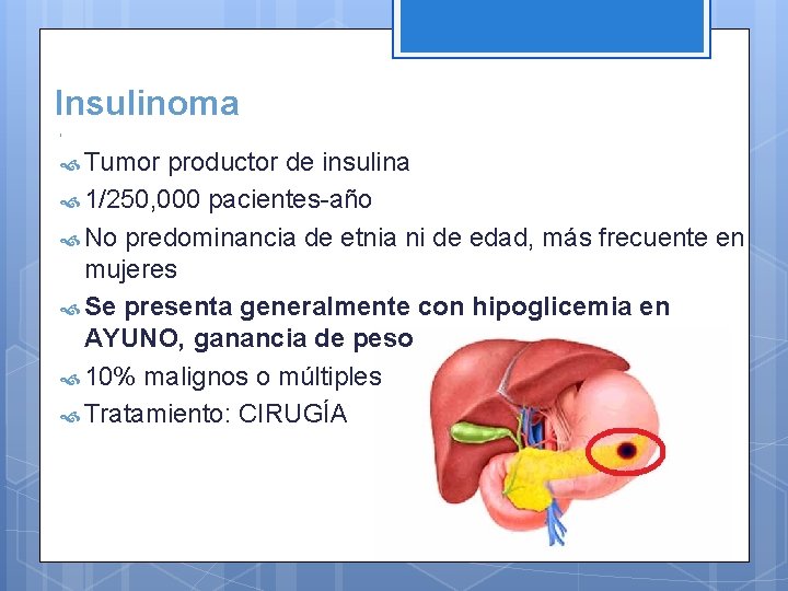 Insulinoma Tumor productor de insulina 1/250, 000 pacientes-año No predominancia de etnia ni de