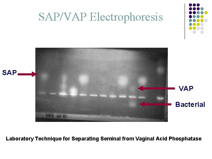 SAP/VAP Electrophoresis SAP VAP Bacterial Laboratory Technique for Separating Seminal from Vaginal Acid Phosphatase