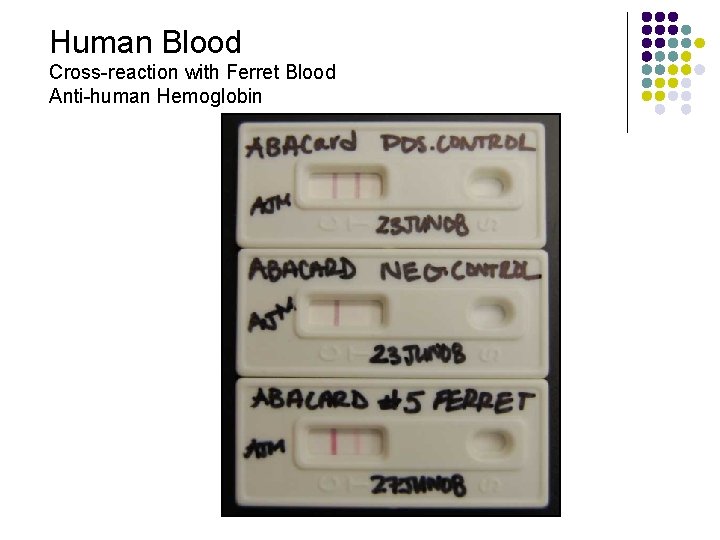Human Blood Cross-reaction with Ferret Blood Anti-human Hemoglobin 